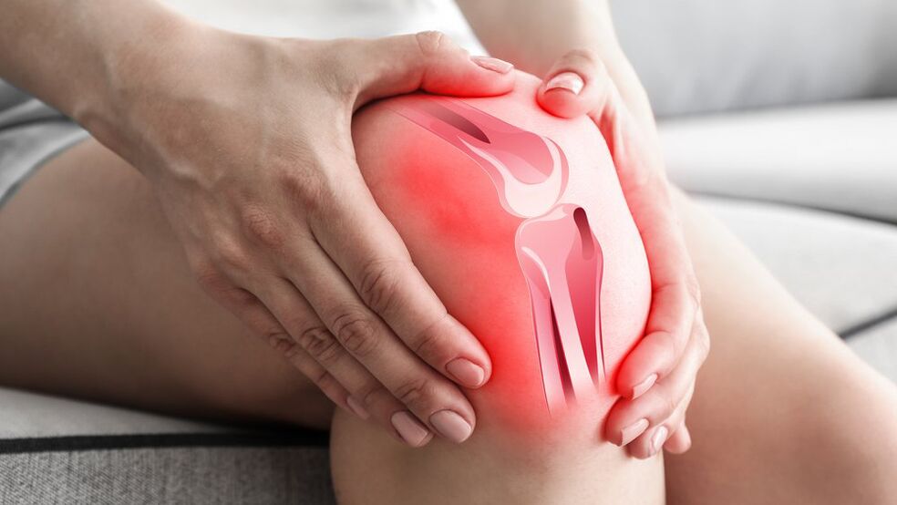 Zdravljenje bolečin v sklepih Osteflex