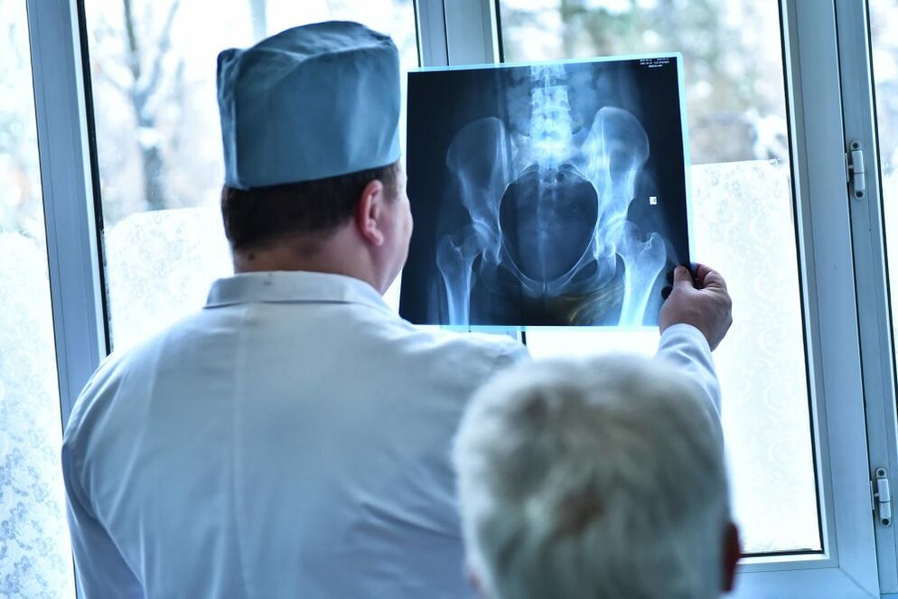 Zdravnik si ogleda sliko kolčnega sklepa z artrozo